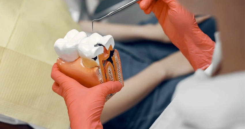 Tooth Sensitivity After a Root Canal