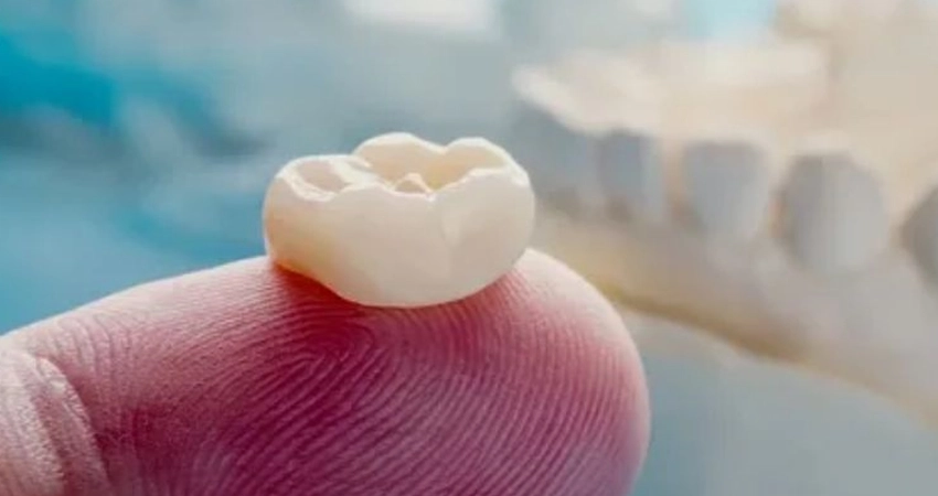 Dental Crowns